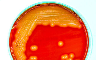Mold 12 | stuart d. Kaplow, p. A.