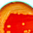 Mold 12 | stuart d. Kaplow, p. A.